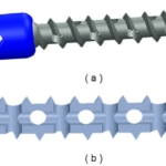 A graphic of the CD Horizon Fenestrated Screw Set, a spinal technology invented by orthopedic surgeon Dr. Gary K. Michelson.