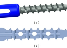 A graphic of the CD Horizon Fenestrated Screw Set, a spinal technology invented by orthopedic surgeon Dr. Gary K. Michelson.