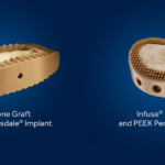 The Infuse Bone Graft/Medtronic Interbody Fusion Device is an invention by orthopedic surgeon Dr. Gary K. Michelson, and is now developed and sold by medical devices manufacturer Medtronic. The system is used on older patients who suffer from degenerative disc disease.