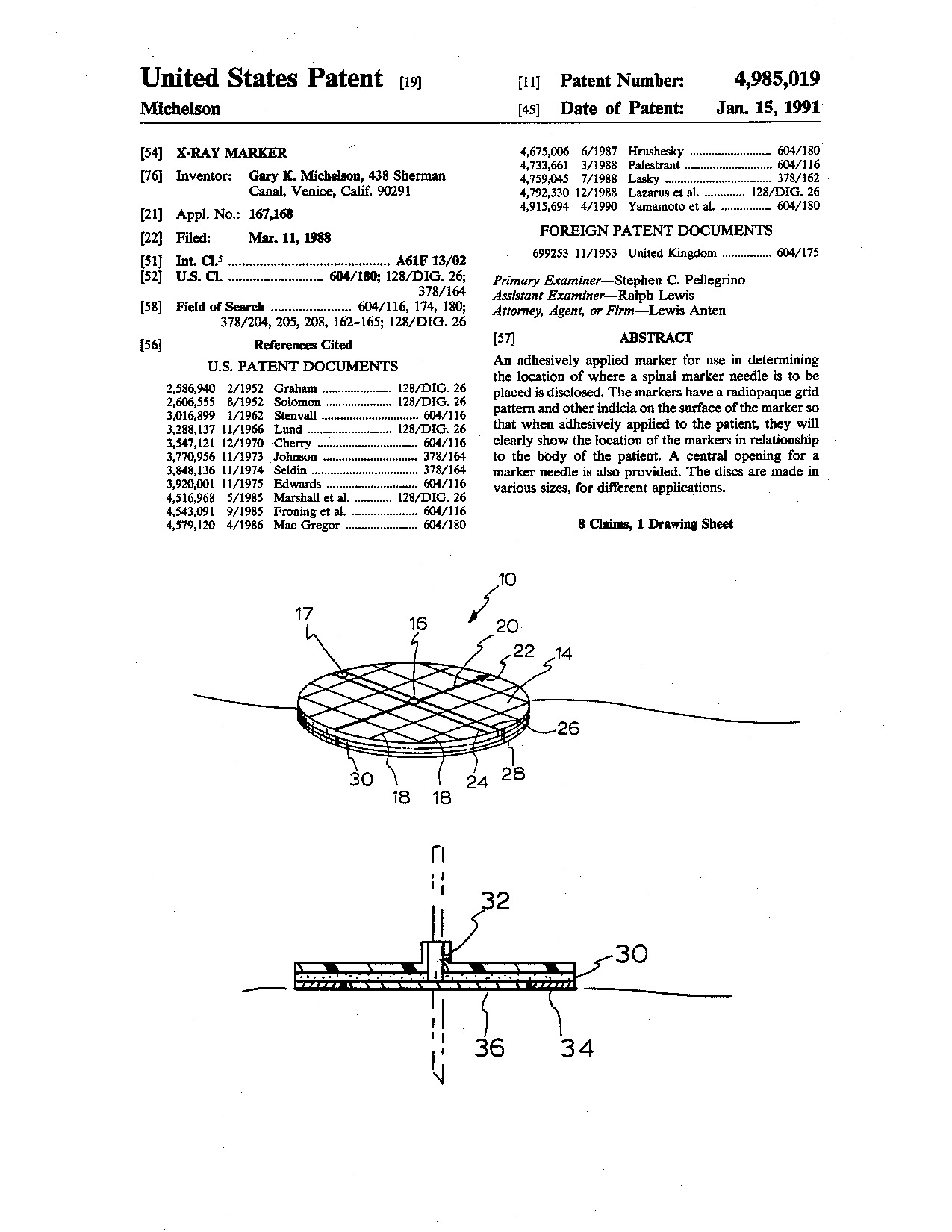 X-ray marker - Patent 4,985,019