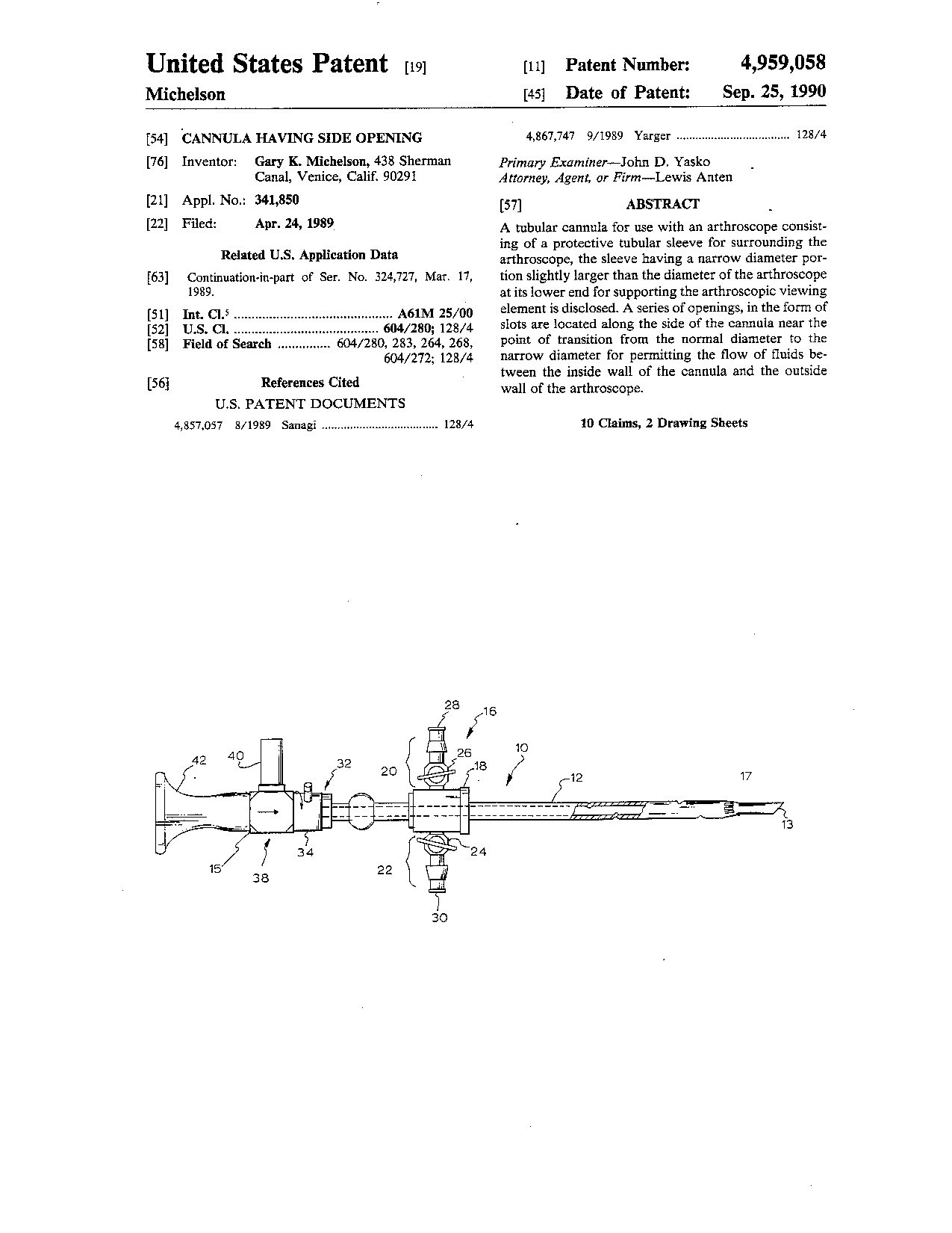 Cannula having side opening - Patent 4,959,058