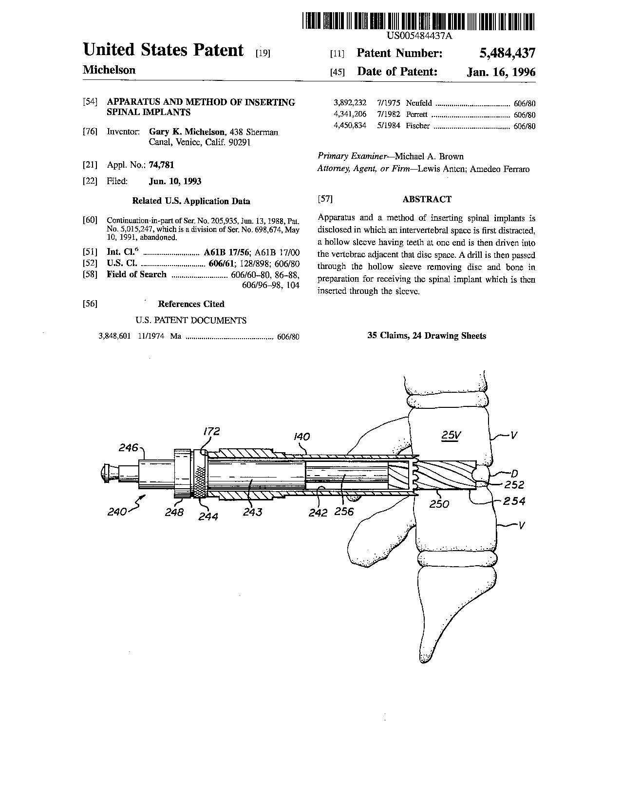 Apparatus and method of inserting spinal implants - Patent 5,484,437