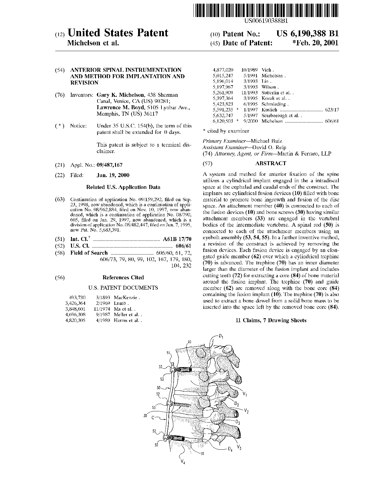 Anterior spinal instrumentation and method for implantation and revision - Patent 6,190,388
