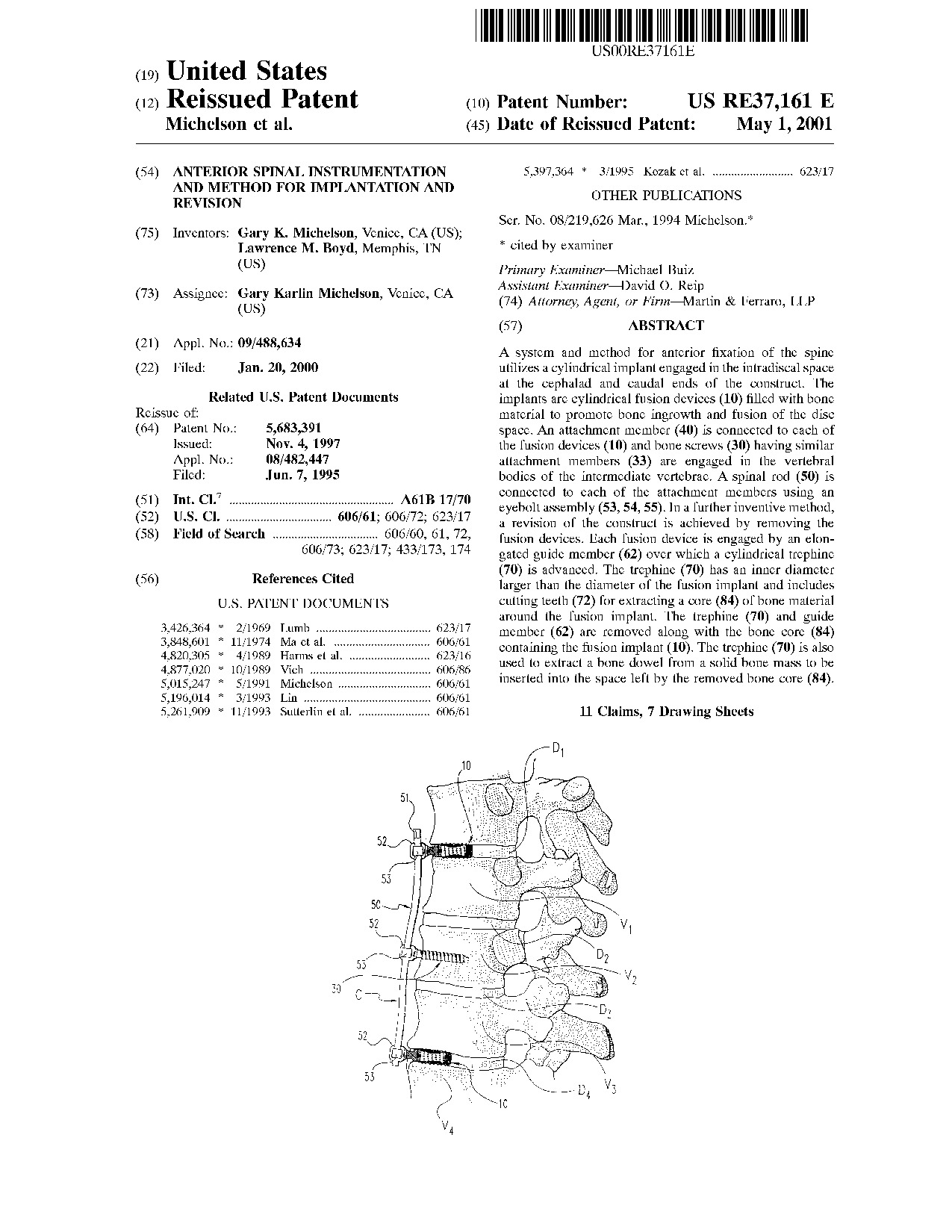 Anterior spinal instrumentation and method for implantation and revision - Patent RE37,161