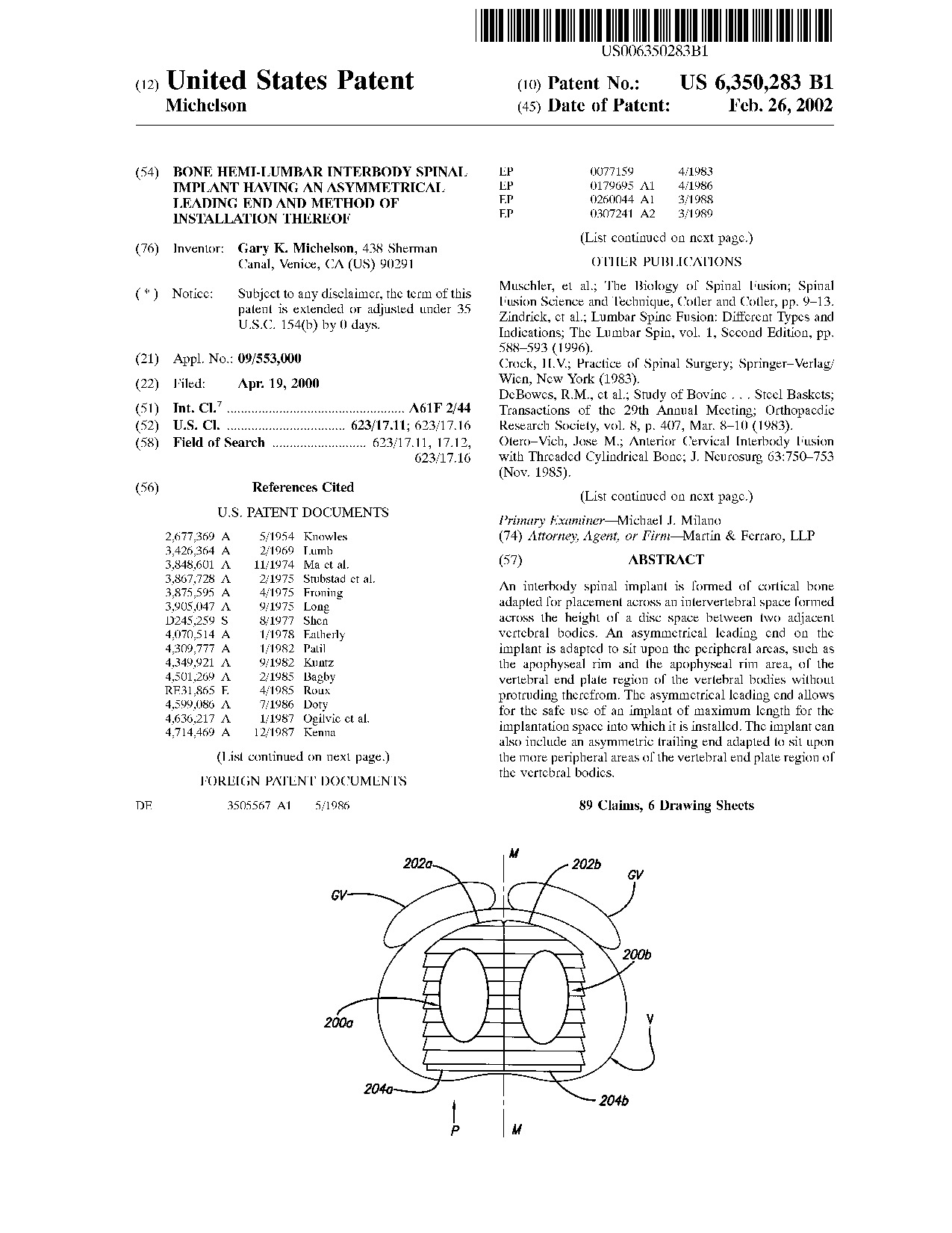 Bone hemi-lumbar interbody spinal implant having an asymmetrical leading     end and method of installation thereof - Patent 6,350,283