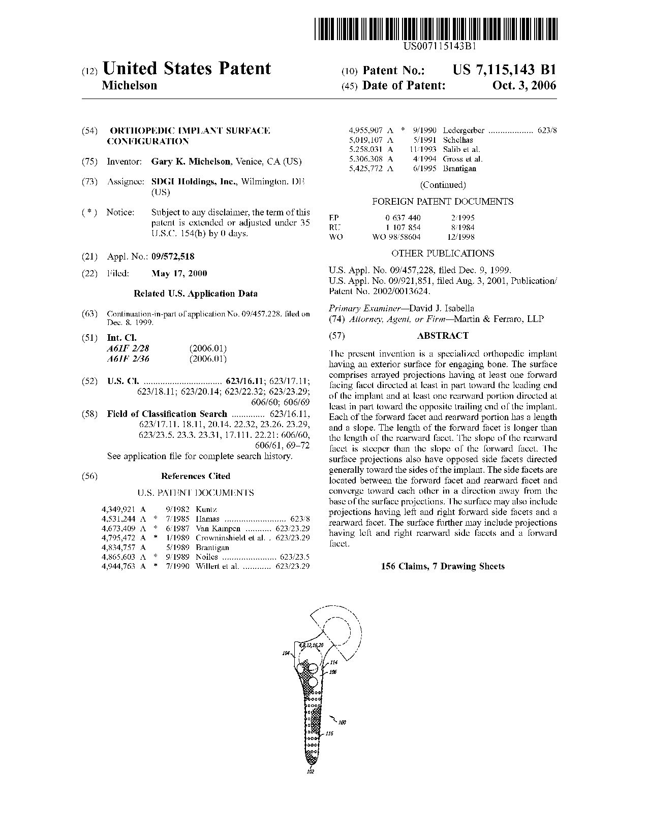 Orthopedic implant surface configuration - Patent 7,115,143