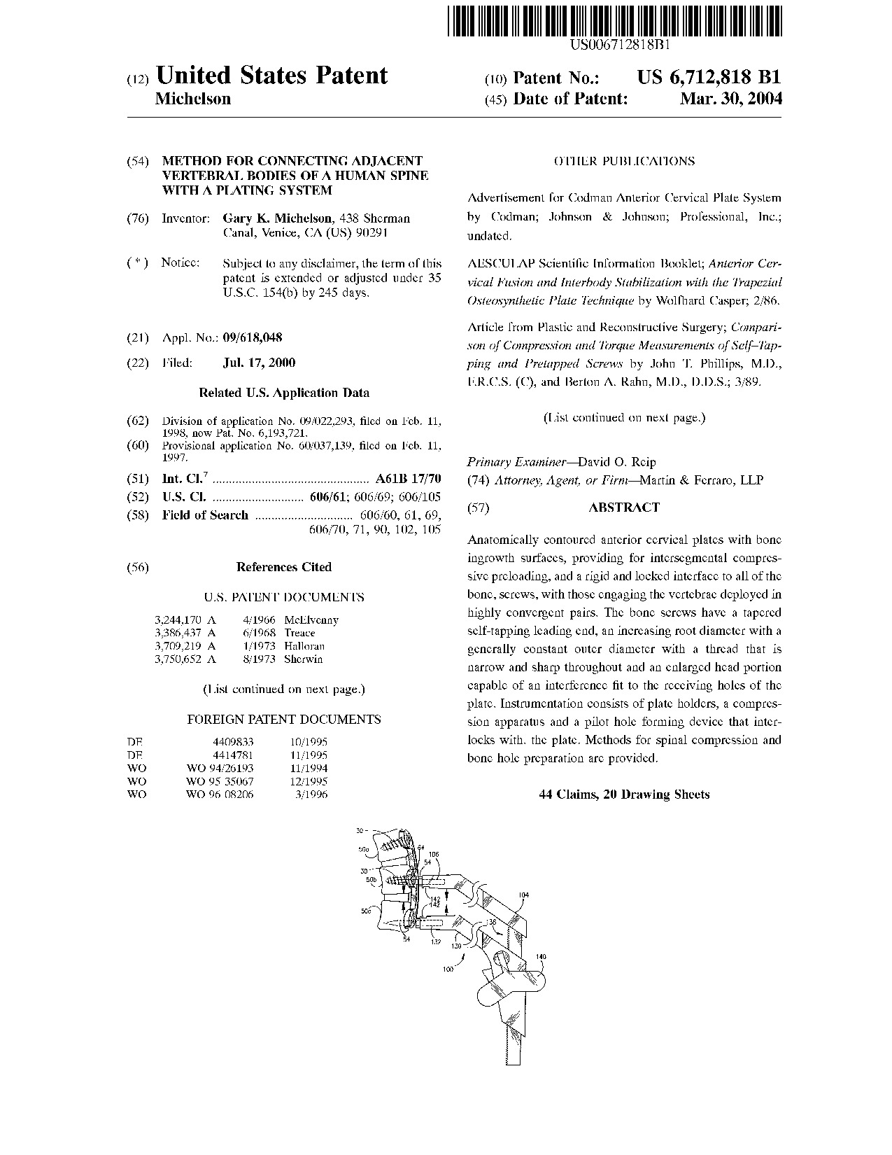 Method for connecting adjacent vertebral bodies of a human spine with a     plating system - Patent 6,712,818