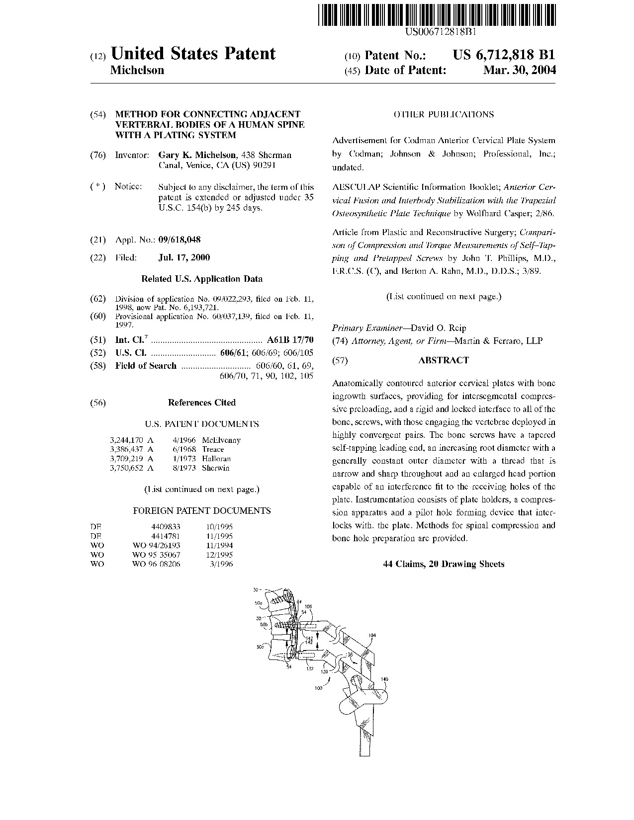 Method for connecting adjacent vertebral bodies of a human spine with a     plating system - Patent 6,712,818