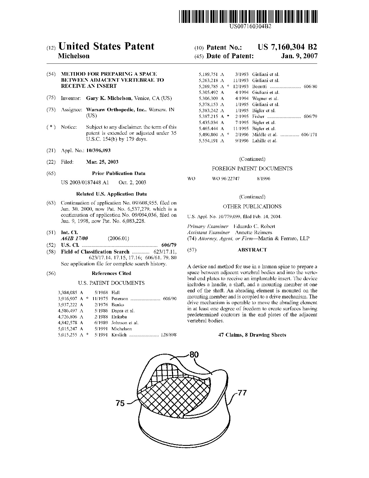 Method for preparing a space between adjacent vertebrae to receive an     insert - Patent 7,160,304