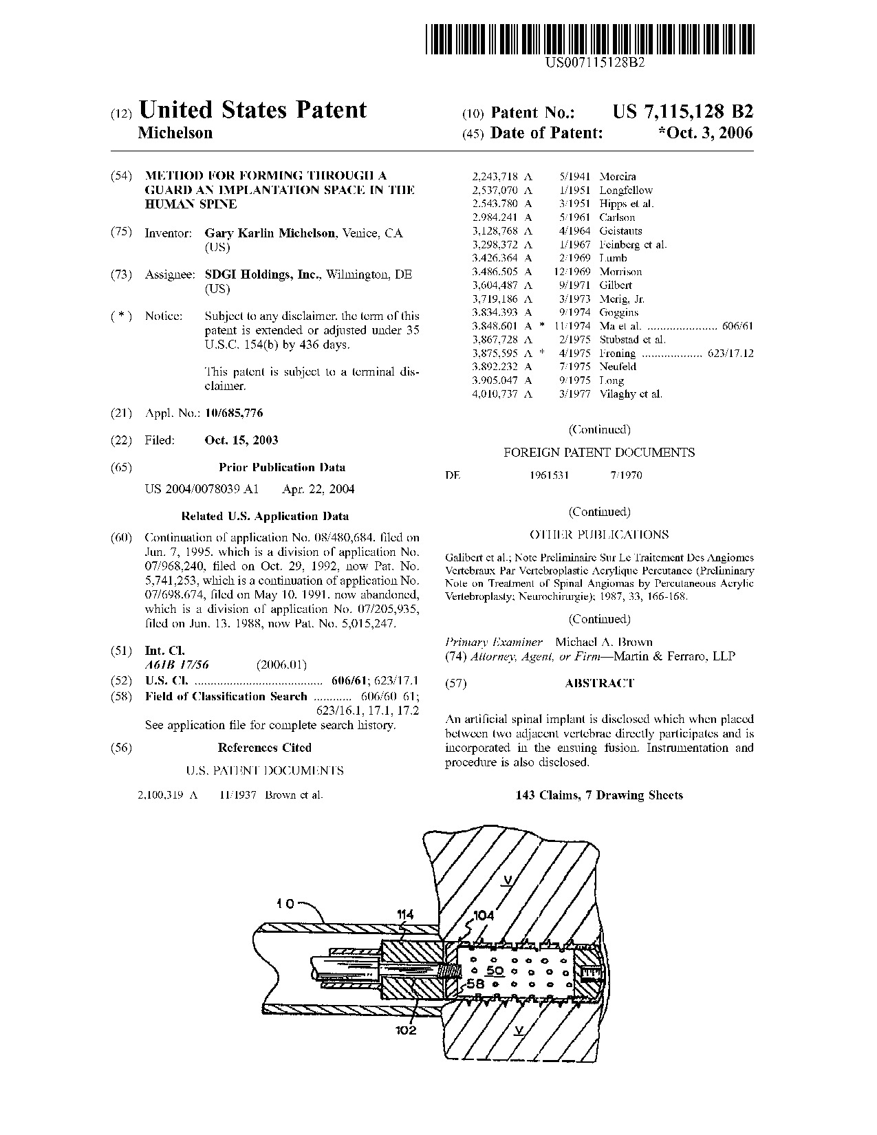 Method for forming through a guard an implantation space in the human     spine - Patent 7,115,128