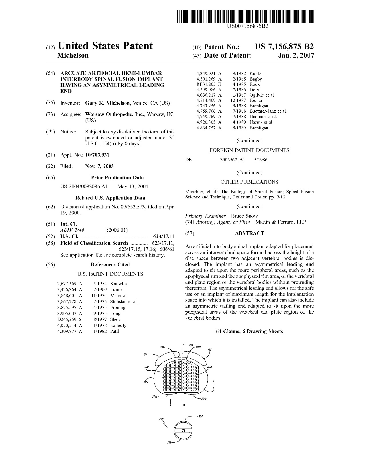 Arcuate artificial hemi-lumbar interbody spinal fusion implant having an     asymmetrical leading end - Patent 7,156,875