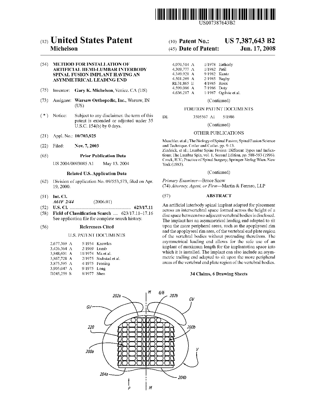 Method for installation of artificial hemi-lumbar interbody spinal fusion     implant having an asymmetrical leading end - Patent 7,387,643