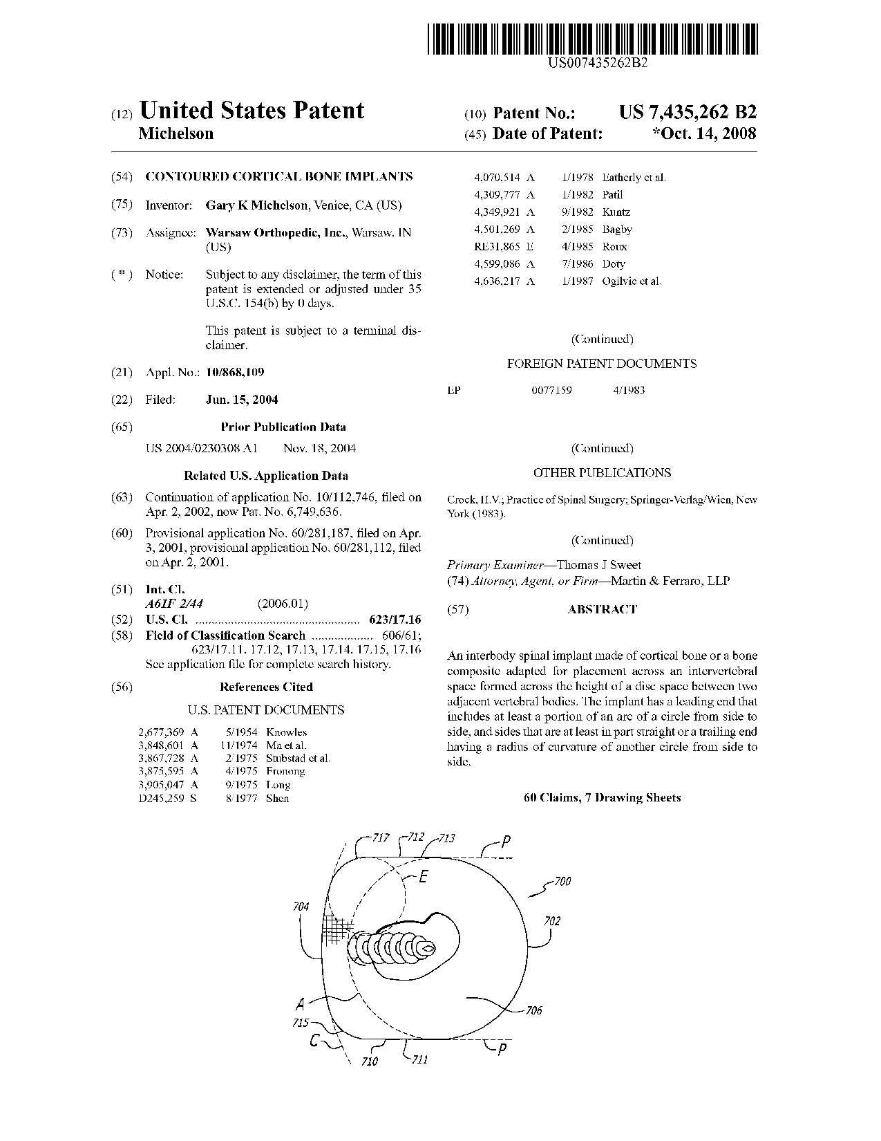 Contoured cortical bone implants - Patent 7,435,262