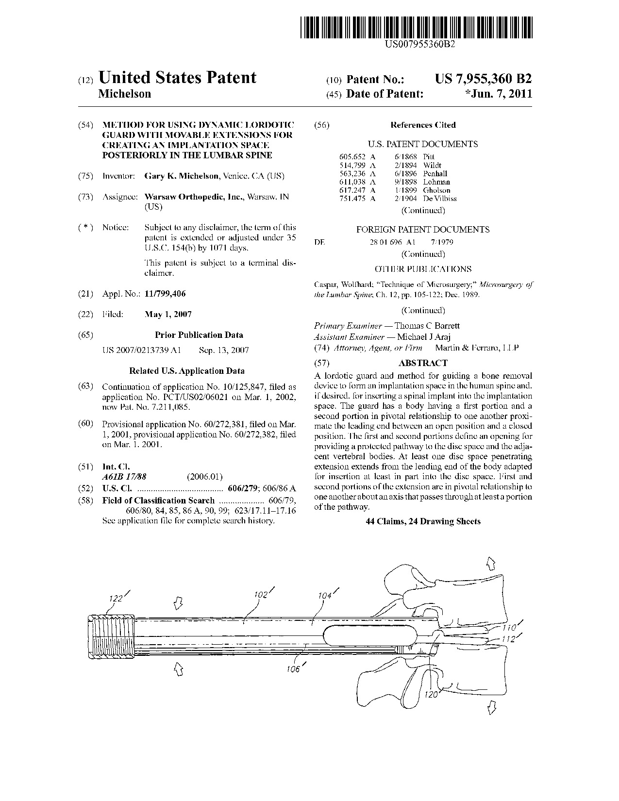 Method for using dynamic lordotic guard with movable extensions for     creating an implantation space posteriorly in the lumbar spine - Patent 7,955,360