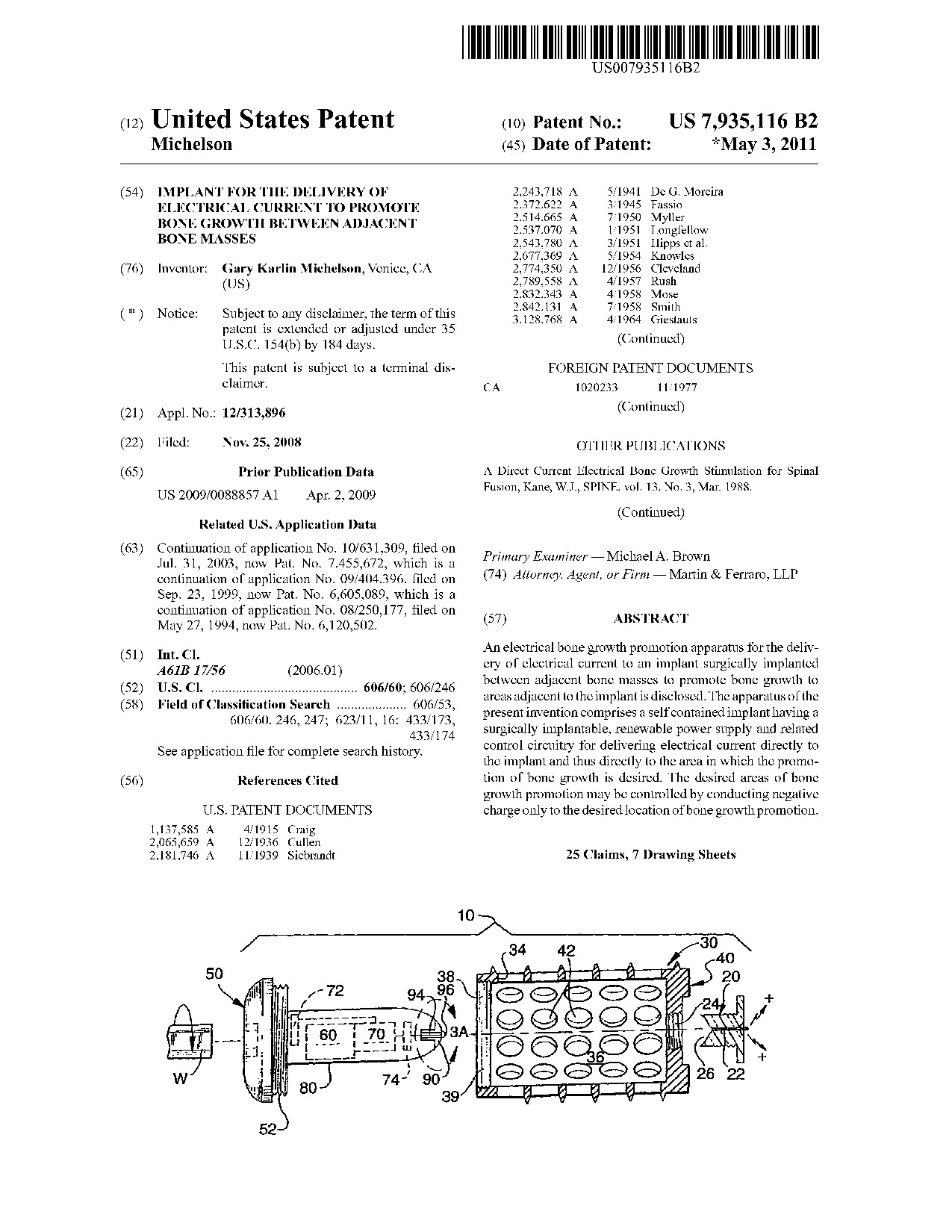 Implant for the delivery of electrical current to promote bone growth     between adjacent bone masses - Patent 7,935,116