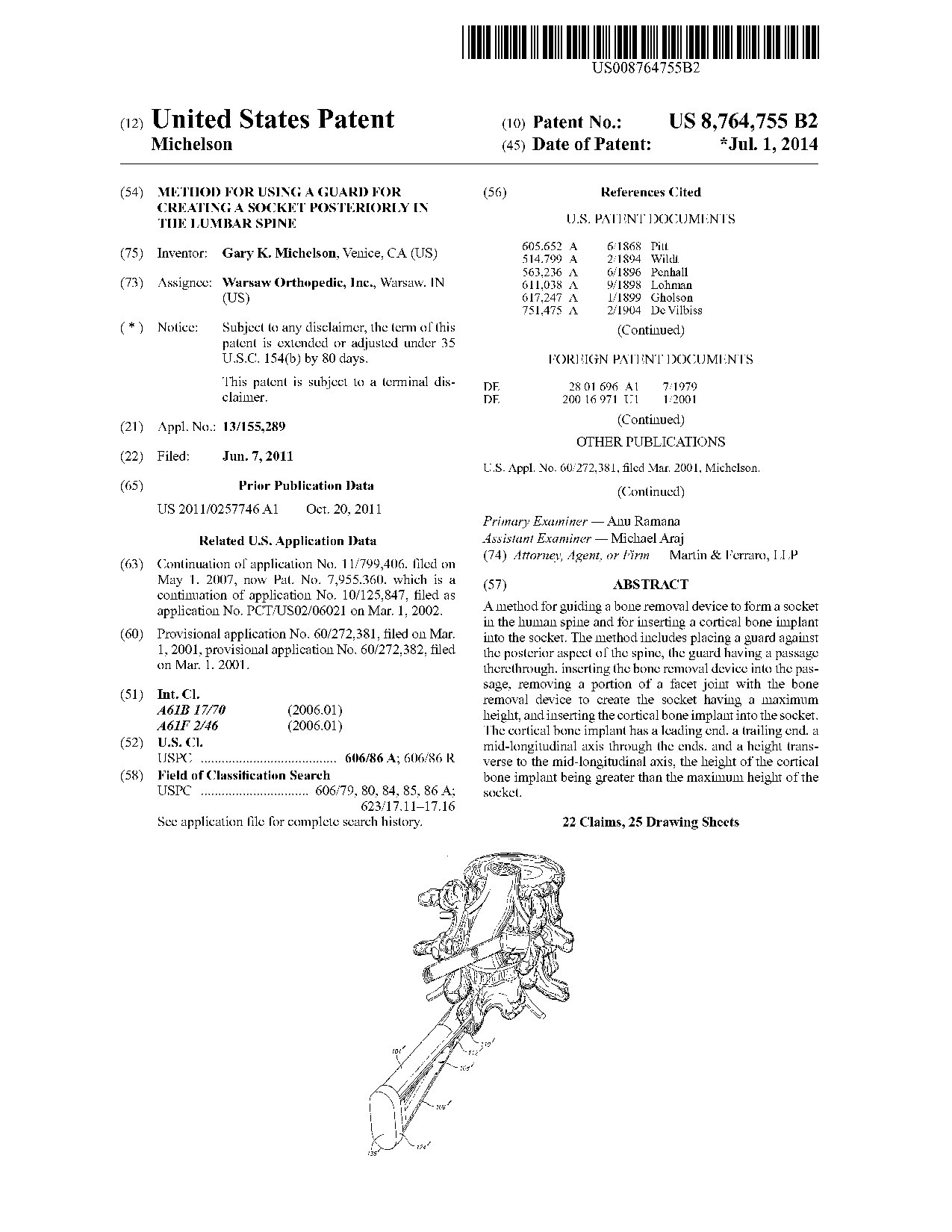 Method for using a guard for creating a socket posteriorly in the lumbar     spine - Patent 8,764,755