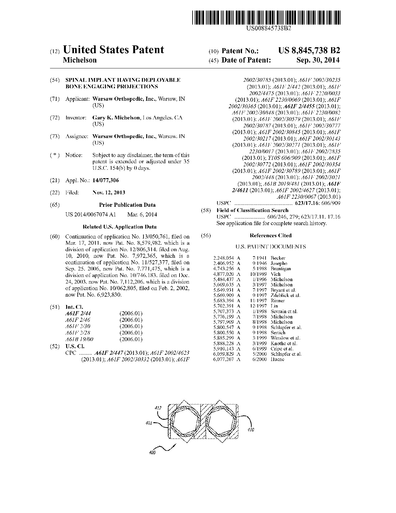 Spinal implant having deployable bone engaging projections - Patent 8,845,738