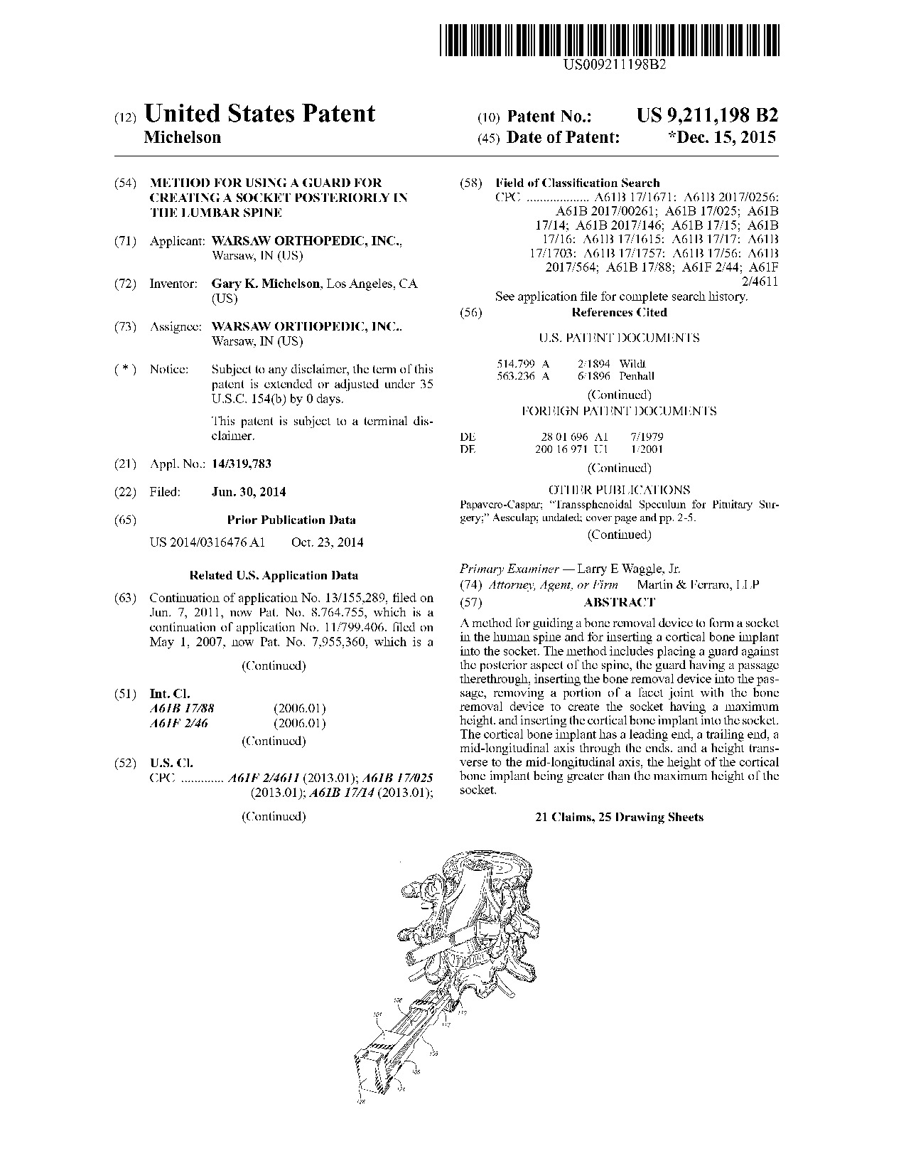 Method for using a guard for creating a socket posteriorly in the lumbar     spine - Patent 9,211,198